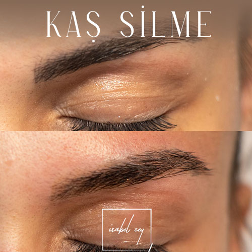 before-after